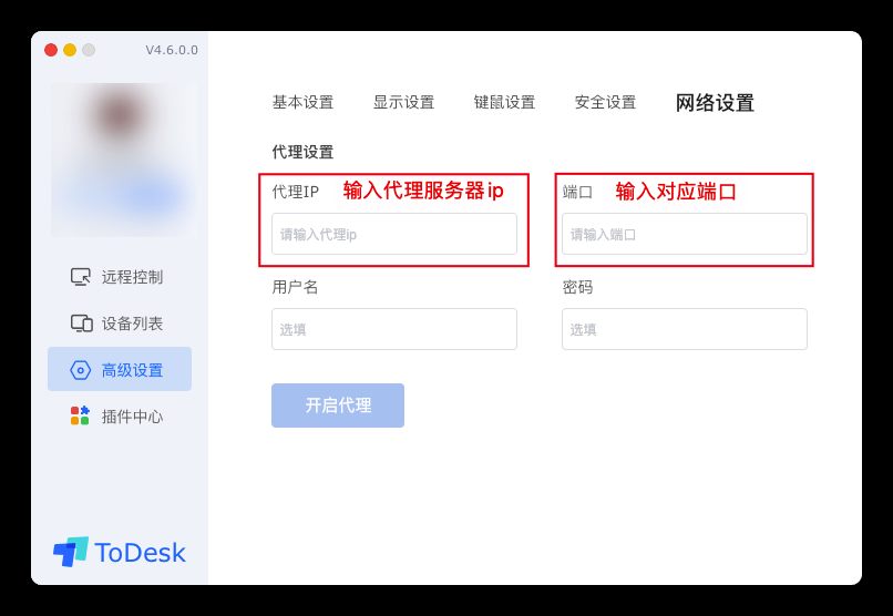 「设置 → 网络」里的代理设置